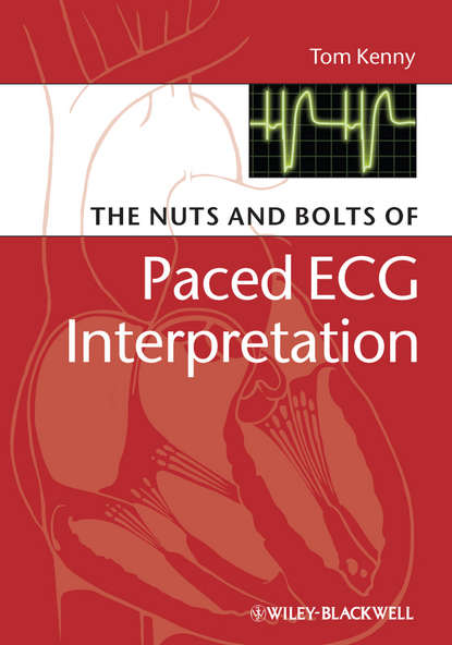 The Nuts and bolts of Paced ECG Interpretation - Группа авторов