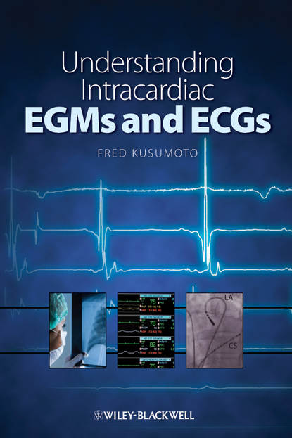 Understanding Intracardiac EGMs and ECGs - Группа авторов