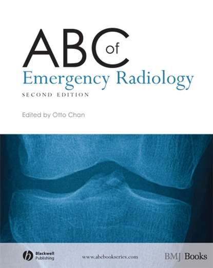 ABC of Emergency Radiology - Группа авторов