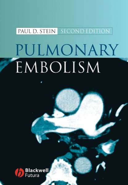 Pulmonary Embolism — Группа авторов