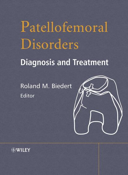 Patellofemoral Disorders — Группа авторов