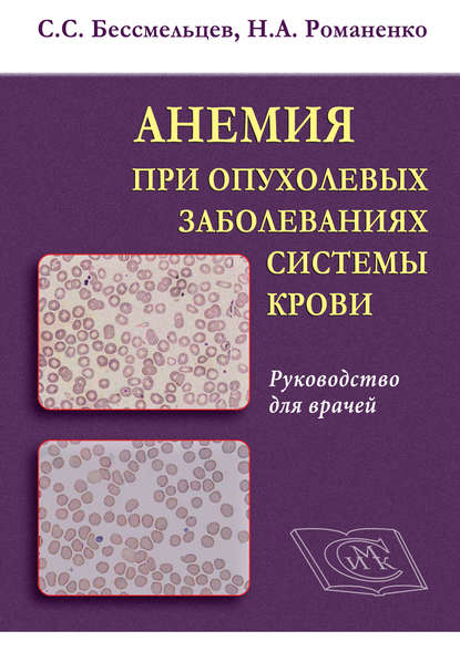 Анемия при опухолевых заболеваниях системы крови. Руководство для врачей — С. С. Бессмельцев