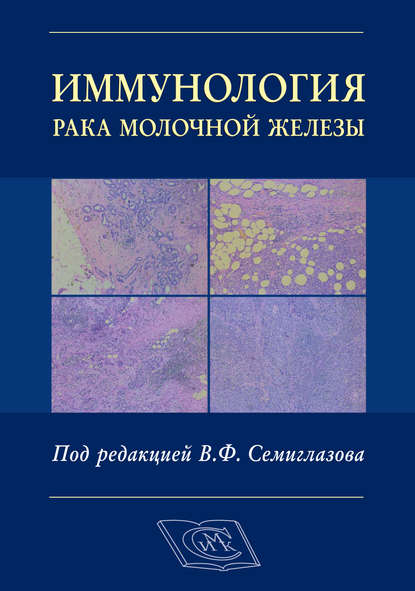 Иммунология рака молочной железы — Коллектив авторов