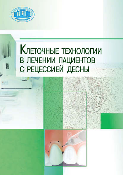 Клеточные технологии в лечении пациентов с рецессией десны - Коллектив авторов